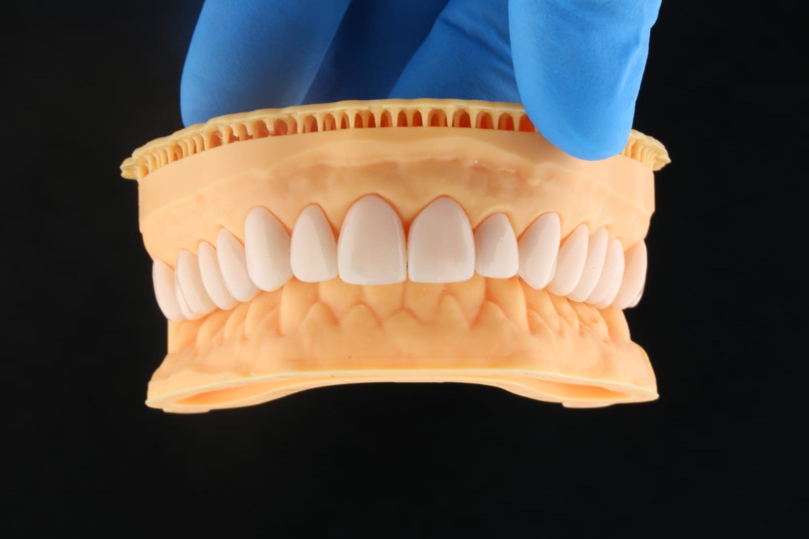 Resultado de diseño de sonrisa en DDS Odontología
